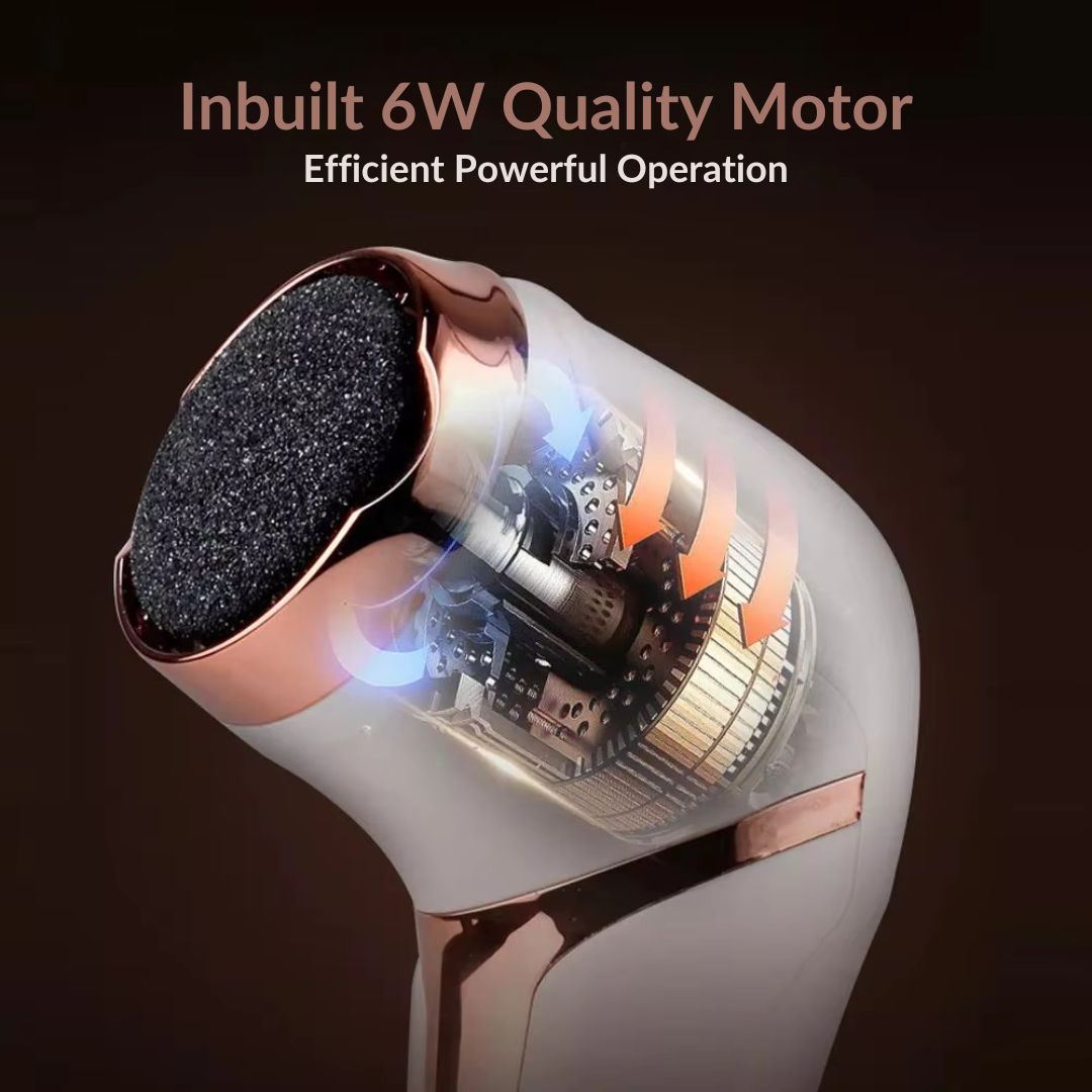 SilkySole™ Callus Remover