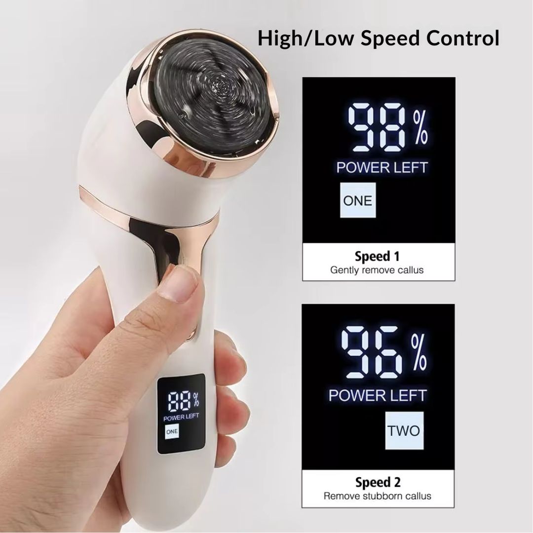 SilkySole™ Callus Remover